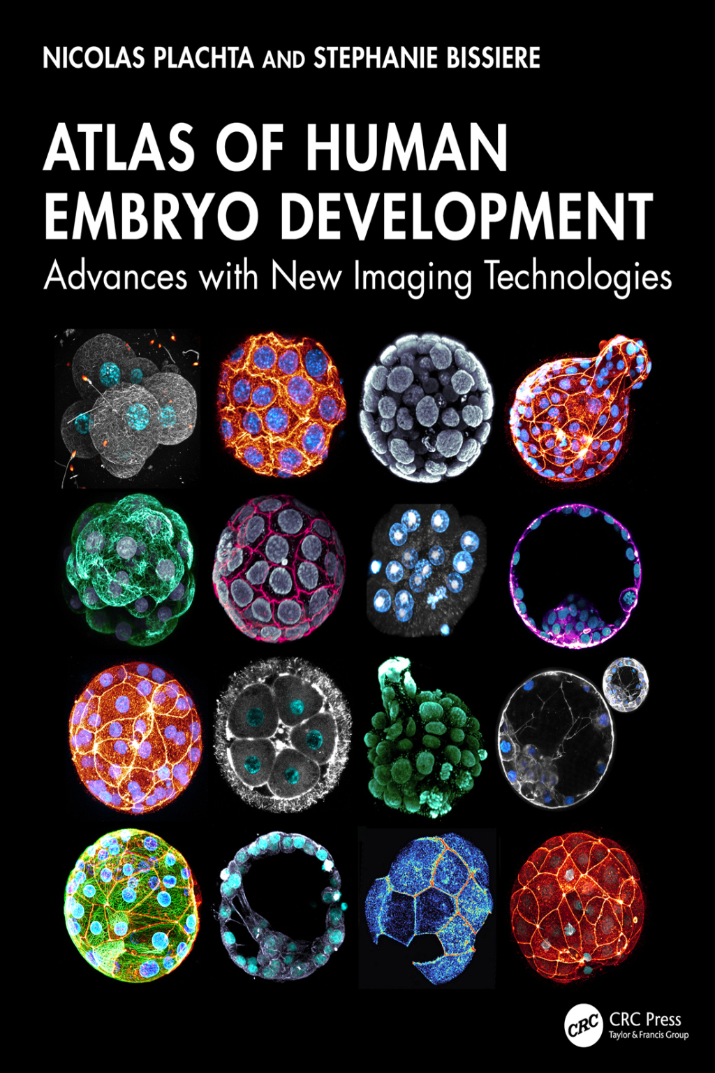 Atlas of Human Embryo Development Advances with New Imaging Technologies 1st Edition â€“ PDF/EPUB Version Downloadable