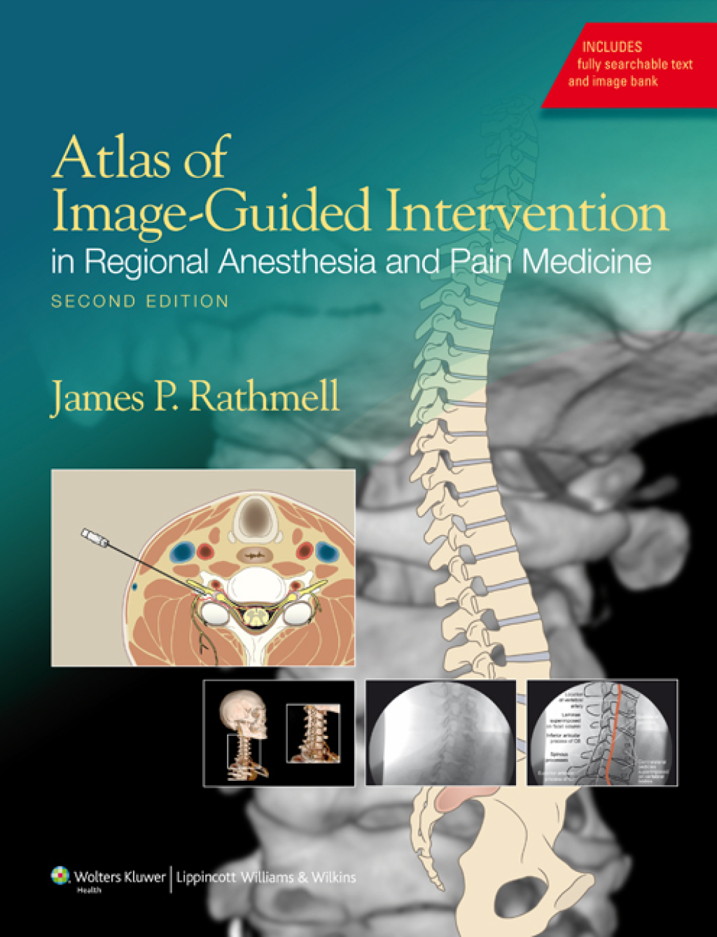 Atlas of Image-Guided Intervention in Regional Anesthesia and Pain Medicine 2nd Edition â€“ PDF/EPUB Version Downloadable