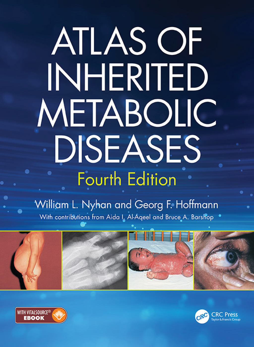 Atlas of Inherited Metabolic Diseases 4th Edition â€“ PDF/EPUB Version Downloadable