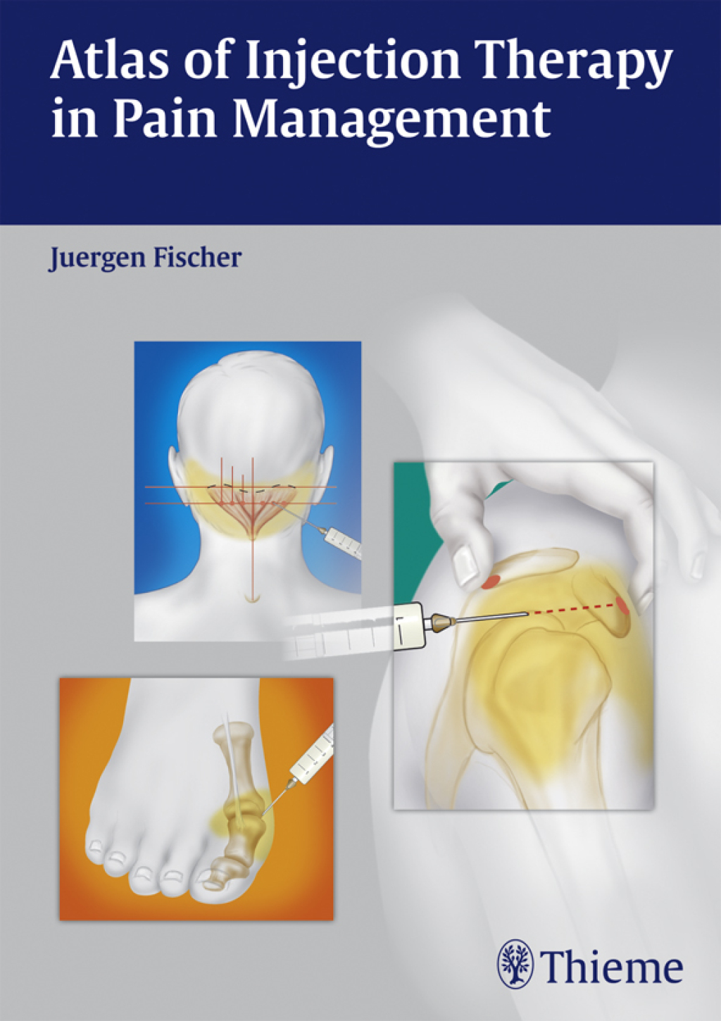 Atlas of Injection Therapy in Pain Management 1st Edition â€“ PDF/EPUB Version Downloadable