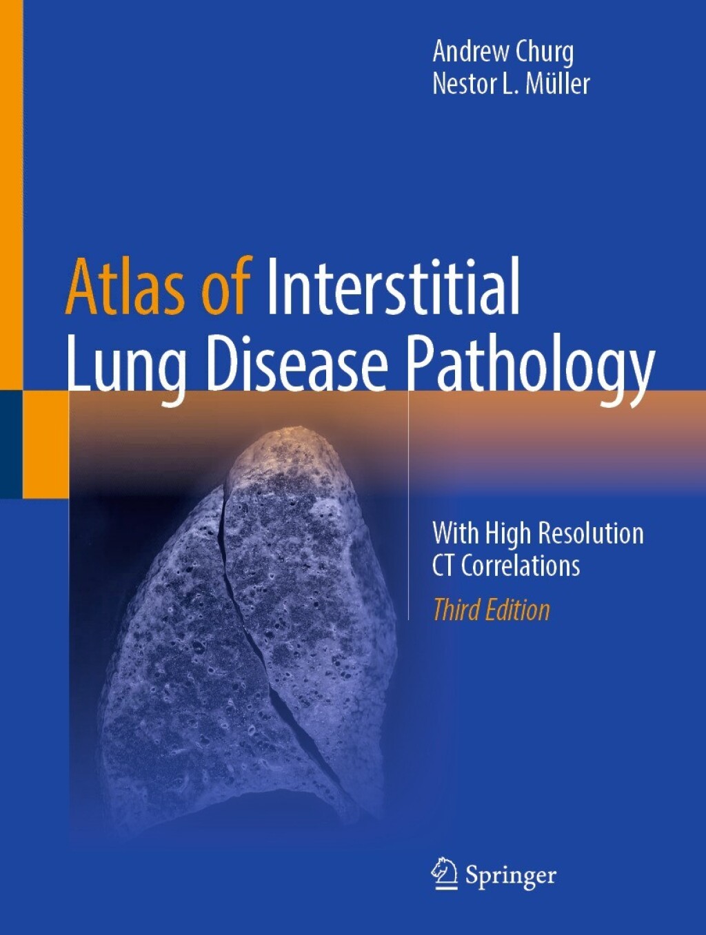 Atlas of Interstitial Lung Disease Pathology With High Resolution CT Correlations 3rd Edition â€“ PDF/EPUB Version Downloadable