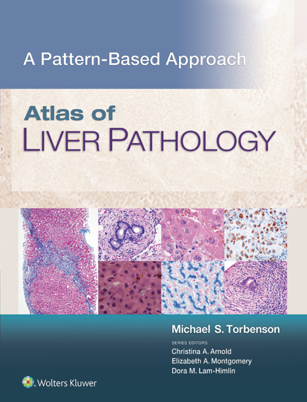Atlas of Liver Pathology: A Pattern-Based Approach â€“ PDF/EPUB Version Downloadable
