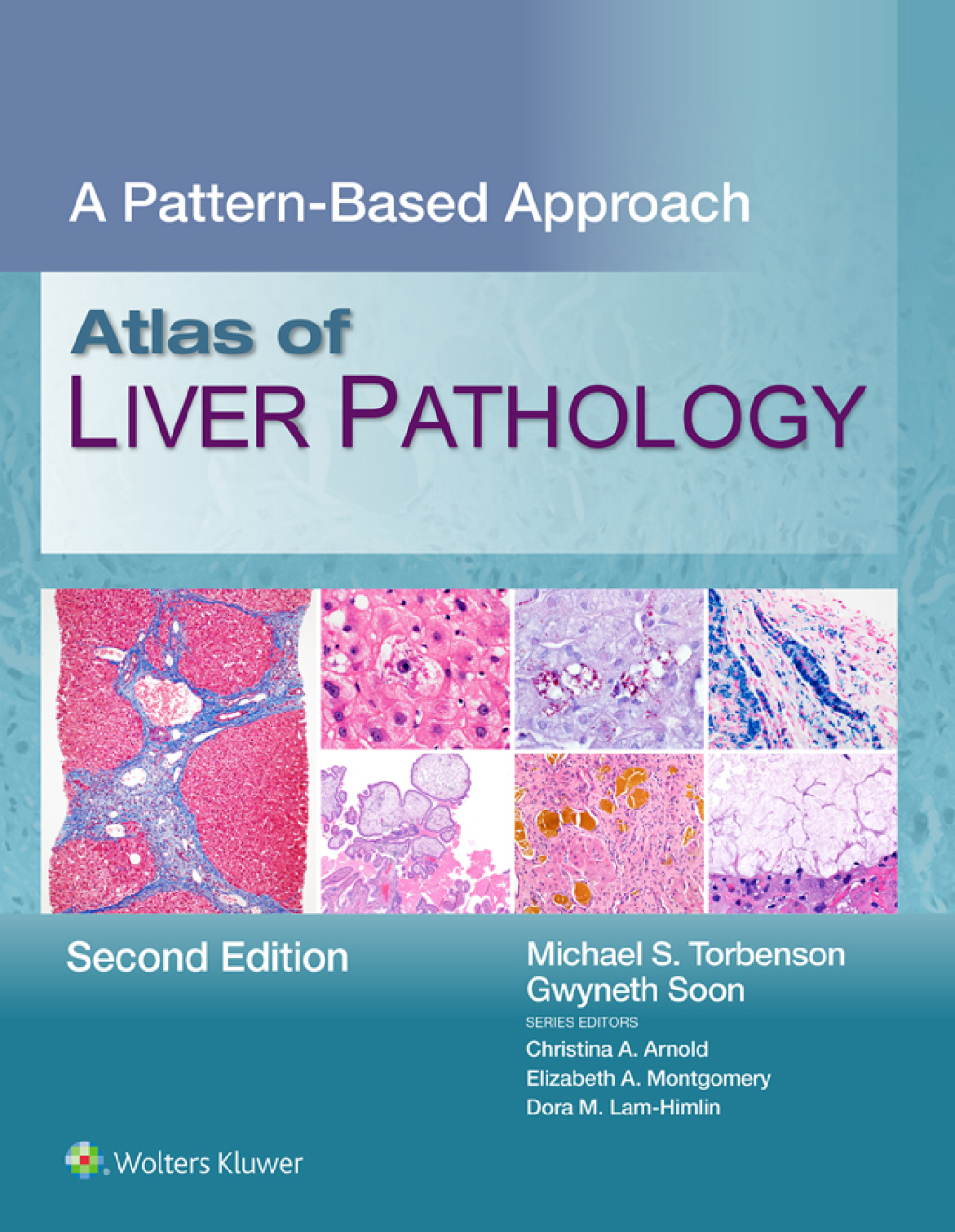 Atlas of Liver Pathology A Pattern-Based Approach 2nd Edition â€“ PDF/EPUB Version Downloadable