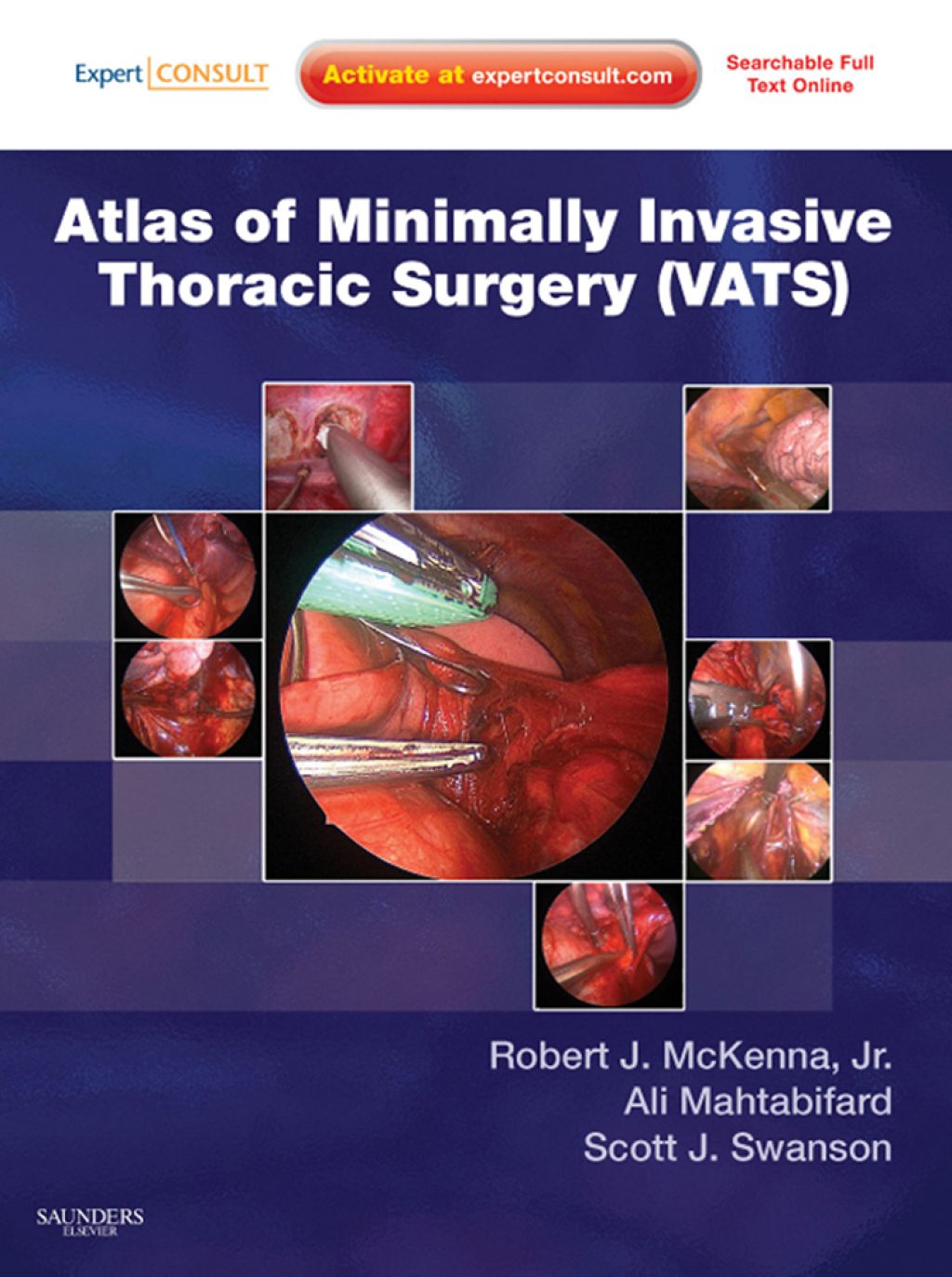 Atlas of Minimally Invasive Thoracic Surgery (VATS) - Electronic 1st Edition â€“ PDF/EPUB Version Downloadable