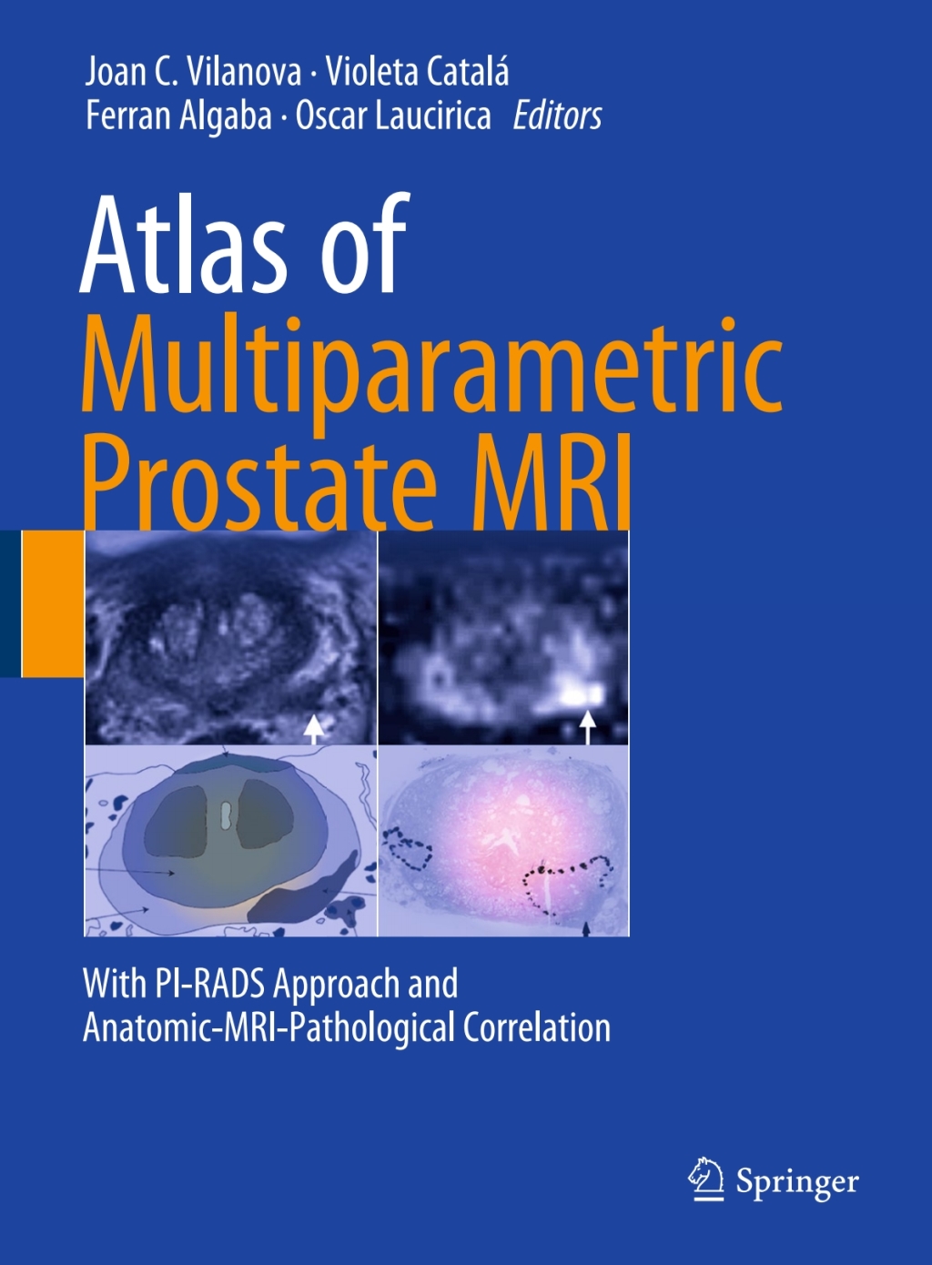 Atlas of Multiparametric Prostate MRI With PI-RADS Approach and ...