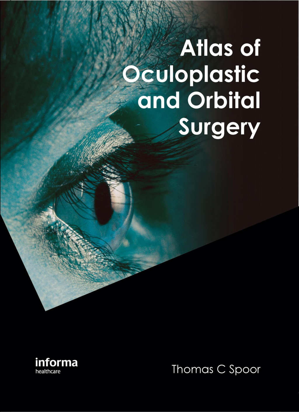Atlas of Oculoplastic and Orbital Surgery 1st Edition â€“ PDF/EPUB Version Downloadable