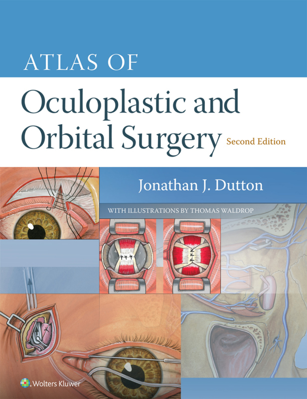 Atlas of Oculoplastic and Orbital Surgery 2nd Edition â€“ PDF/EPUB Version Downloadable