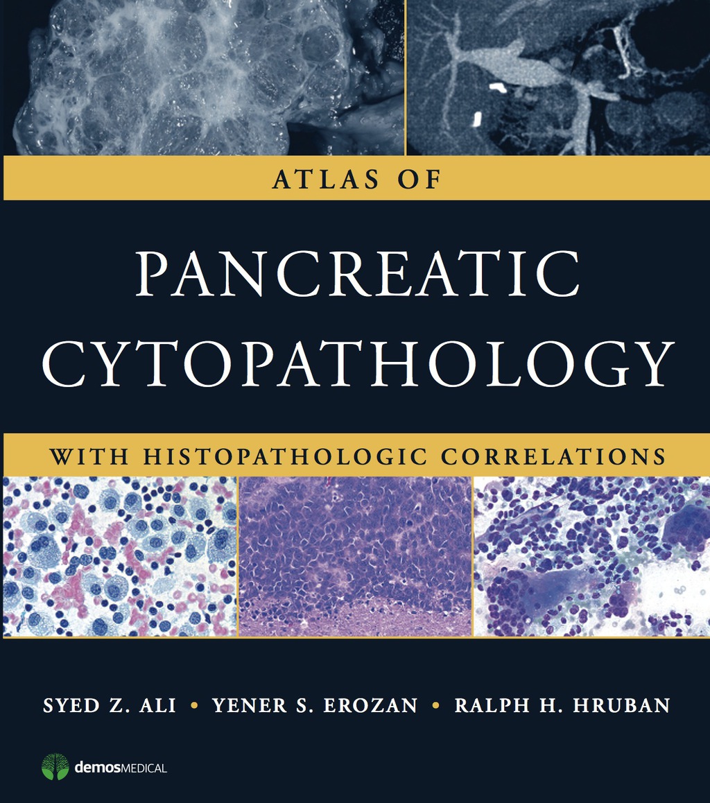 Atlas of Pancreatic Cytopathology With Histopathologic Correlations 1st Edition â€“ PDF/EPUB Version Downloadable