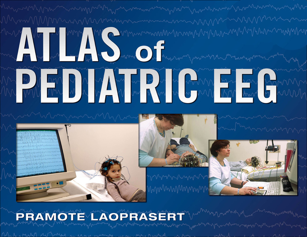 Atlas of Pediatric EEG 1st Edition â€“ PDF/EPUB Version Downloadable