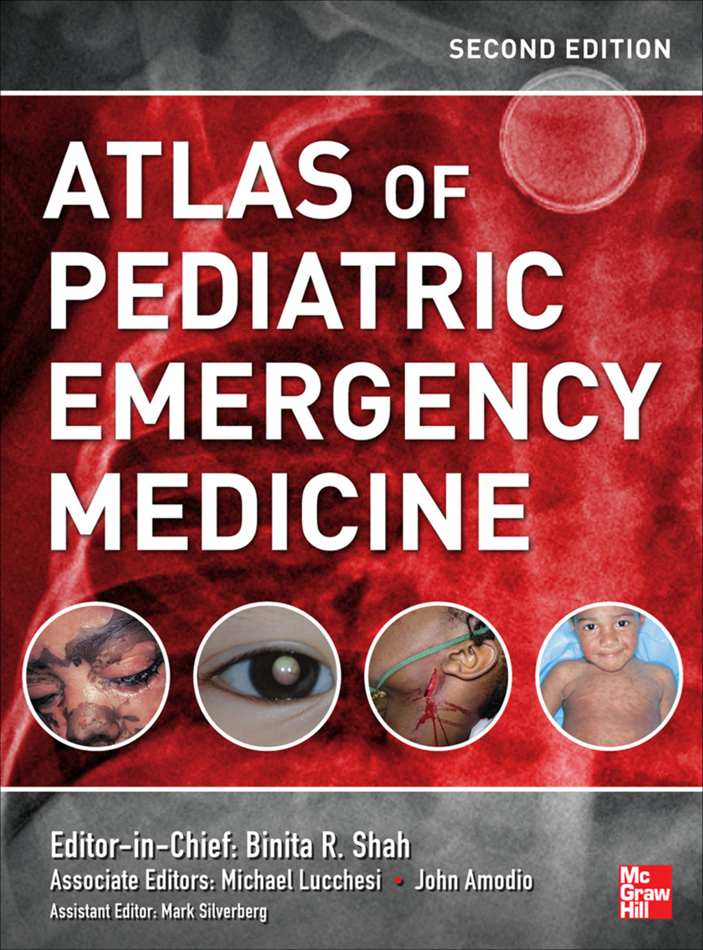 Atlas of Pediatric Emergency Medicine, Second Edition 2nd Edition â€“ PDF/EPUB Version Downloadable