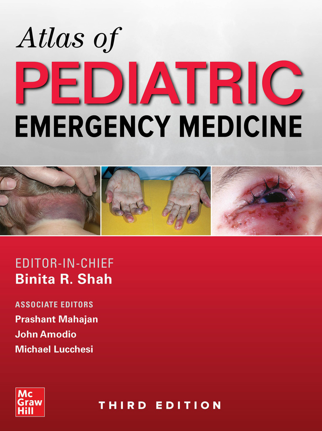 Atlas of Pediatric Emergency Medicine, Third Edition 3rd Edition â€“ PDF/EPUB Version Downloadable
