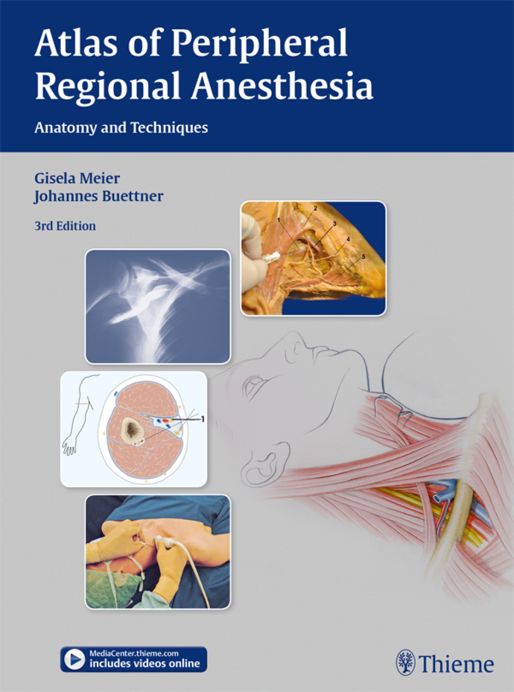 Atlas of Peripheral Regional Anesthesia Anatomy and Techniques 3rd Edition â€“ PDF/EPUB Version Downloadable