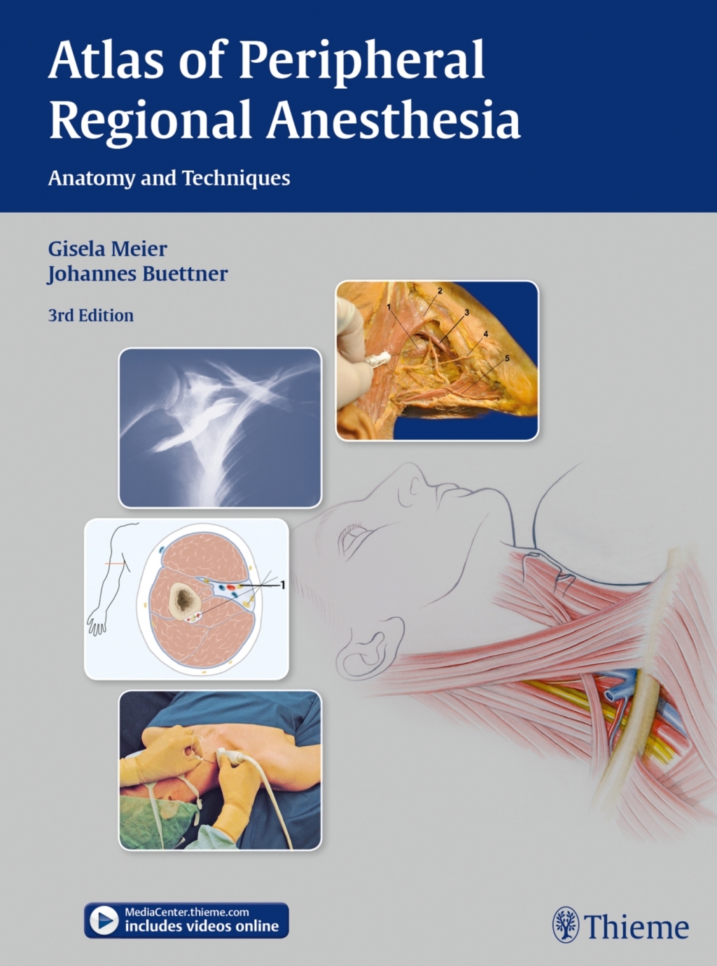 Atlas of Peripheral Regional Anesthesia Anatomy and Techniques 3rd Edition â€“ PDF/EPUB Version Downloadable
