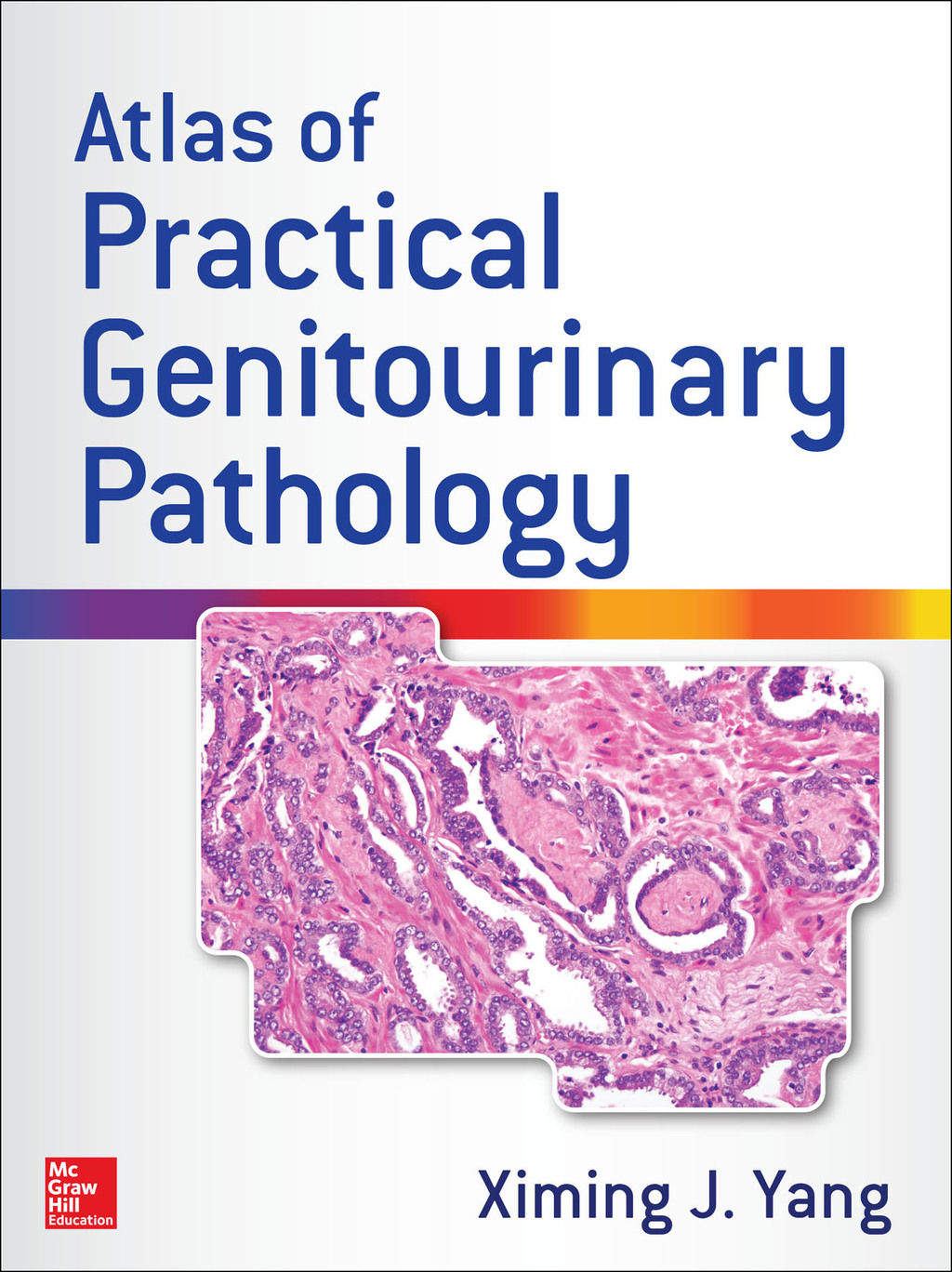 Atlas of Practical Genitourinary Pathology 1st Edition â€“ PDF/EPUB Version Downloadable