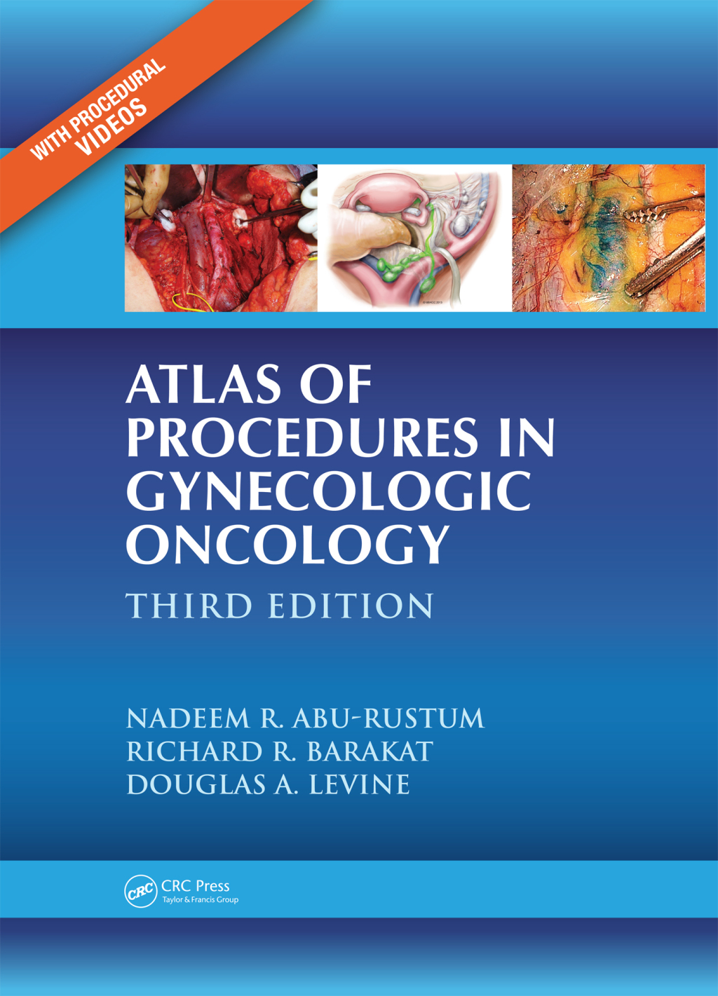 Atlas of Procedures in Gynecologic Oncology 3rd Edition â€“ PDF/EPUB Version Downloadable