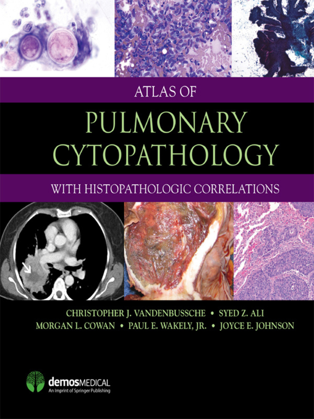Atlas of Pulmonary Cytopathology 1st Edition â€“ PDF/EPUB Version Downloadable