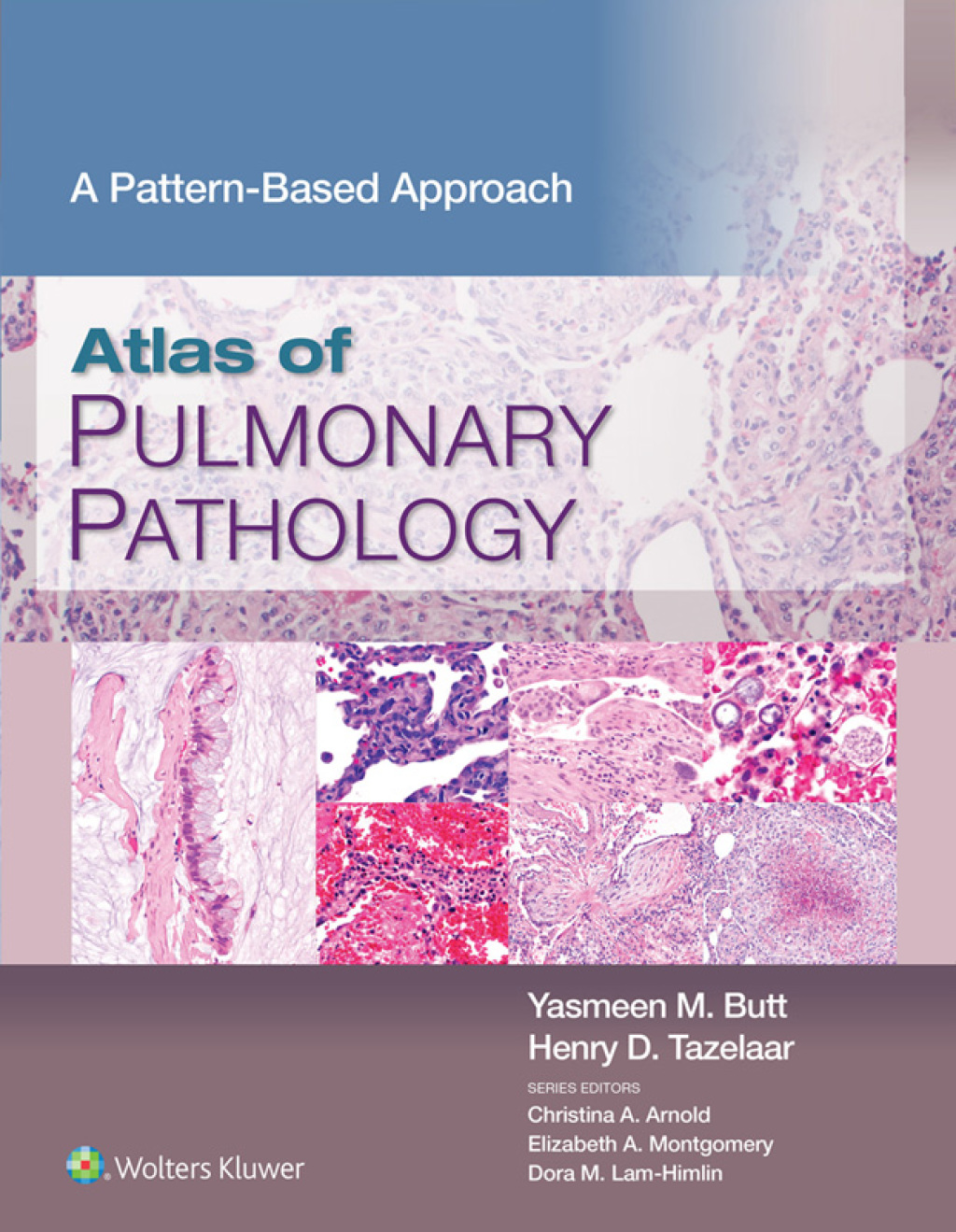 Atlas of Pulmonary Pathology A Pattern Based Approach â€“ PDF/EPUB ...
