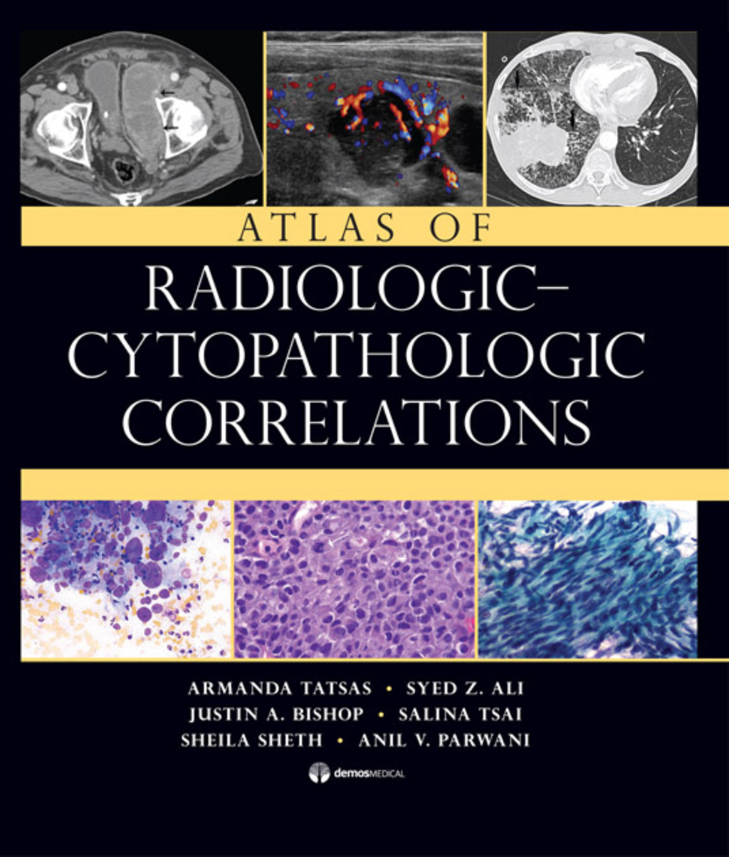 Atlas of Radiologic-Cytopathologic Correlations 1st Edition â€“ PDF/EPUB Version Downloadable