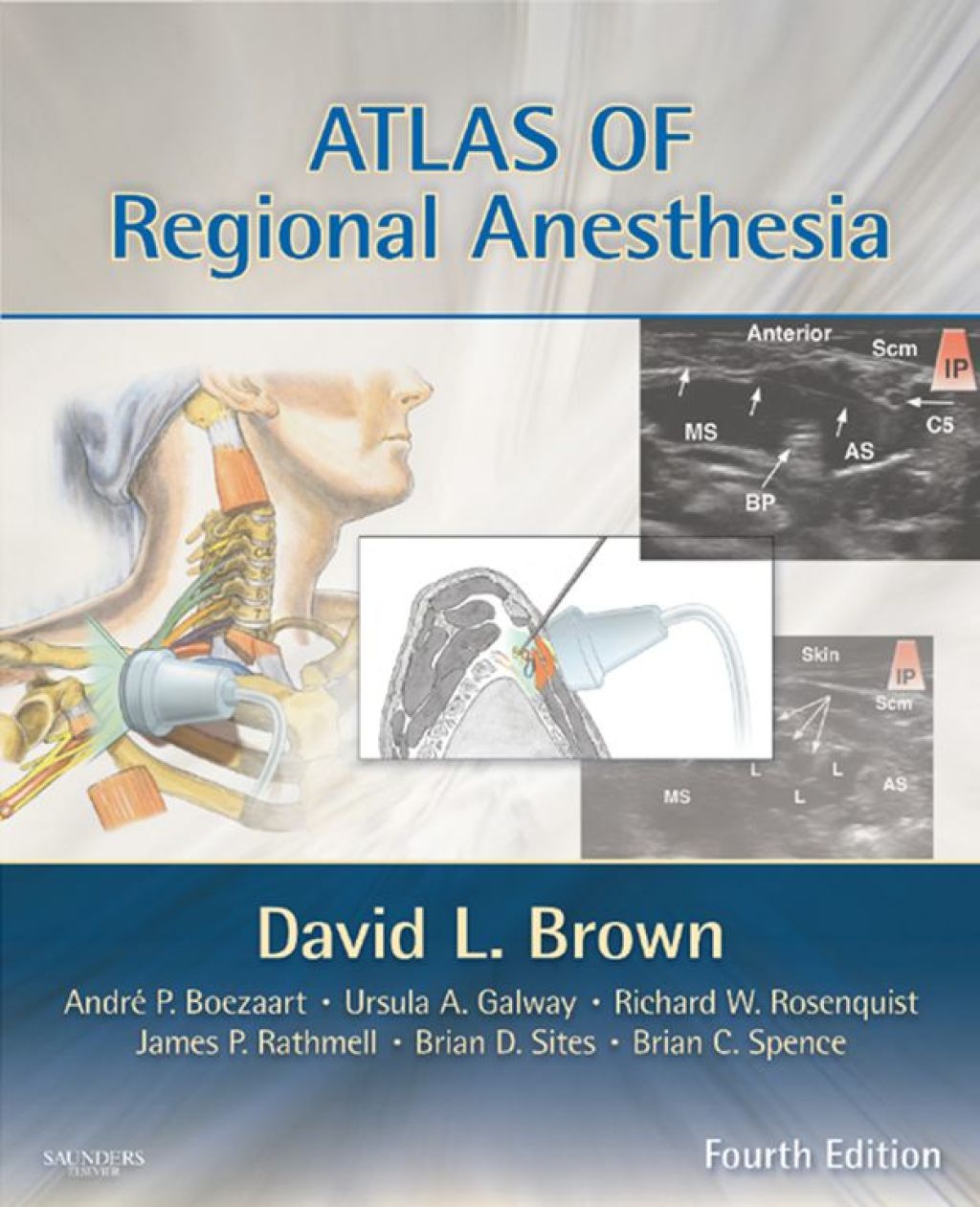 Atlas of Regional Anesthesia 4th Edition â€“ PDF/EPUB Version Downloadable