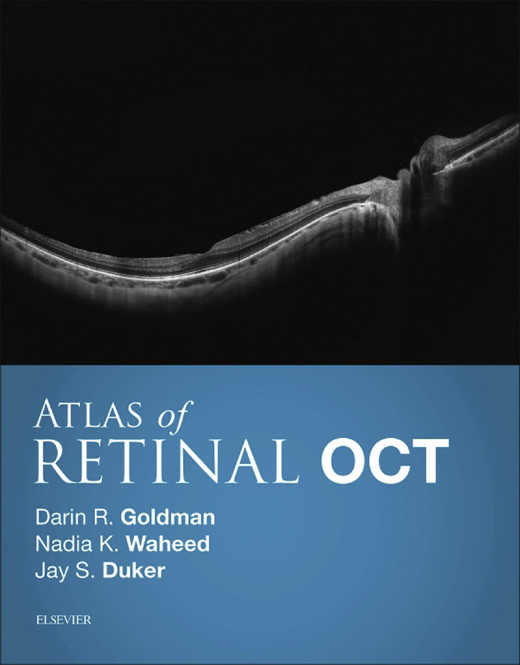 Atlas of Retinal OCT: Optical Coherence Tomography â€“ PDF/EPUB Version Downloadable