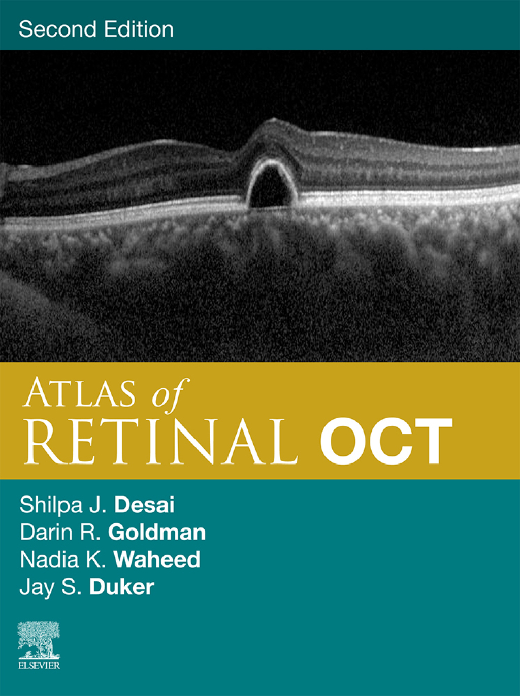 Atlas of Retinal OCT: Optical Coherence Tomography 2nd Edition â€“ PDF/EPUB Version Downloadable