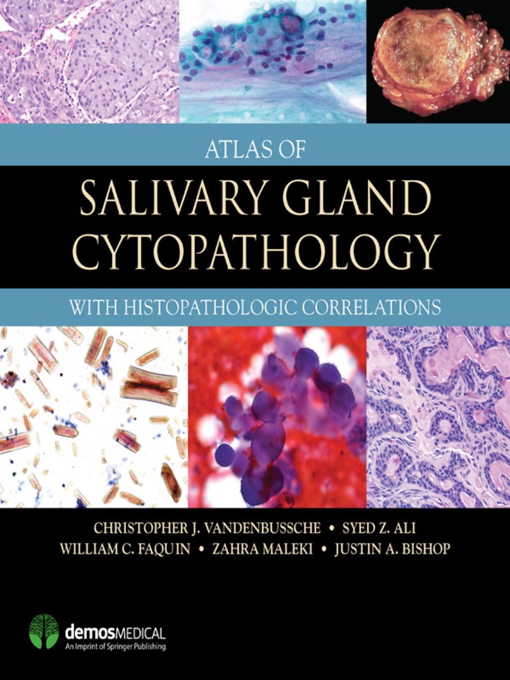 Atlas of Salivary Gland Cytopathology with Histopathologic Correlations 1st Edition â€“ PDF/EPUB Version Downloadable