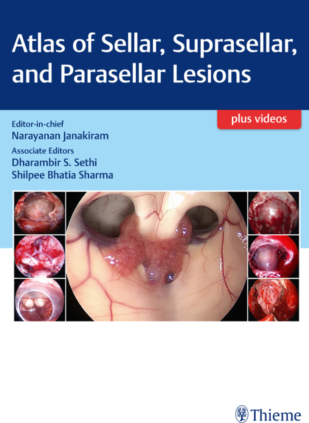 Atlas of Sellar, Suprasellar, and Parasellar Lesions 1st Edition â€“ PDF/EPUB Version Downloadable