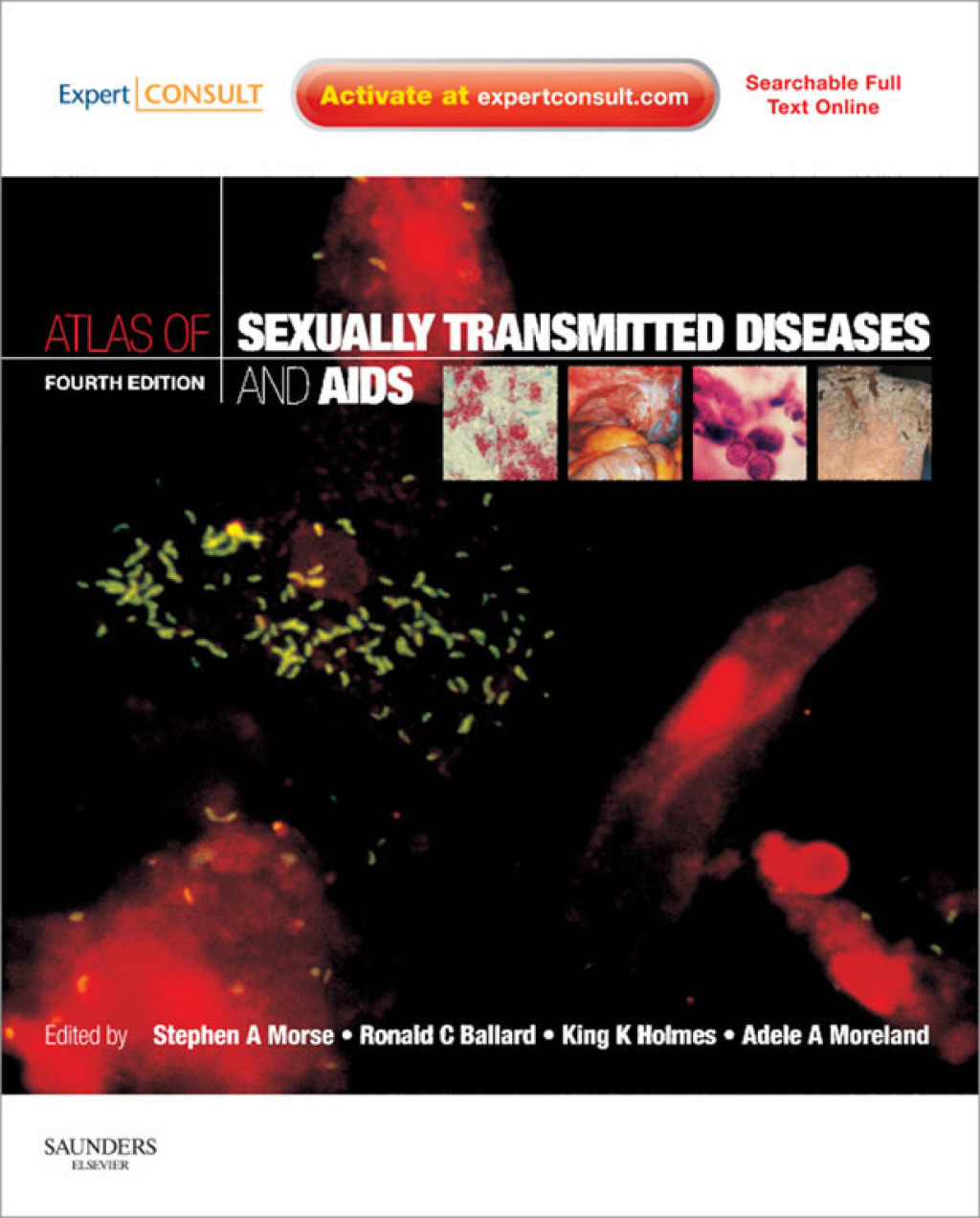Atlas of Sexually Transmitted Diseases and AIDS - Electronic 4th Edition â€“ PDF/EPUB Version Downloadable