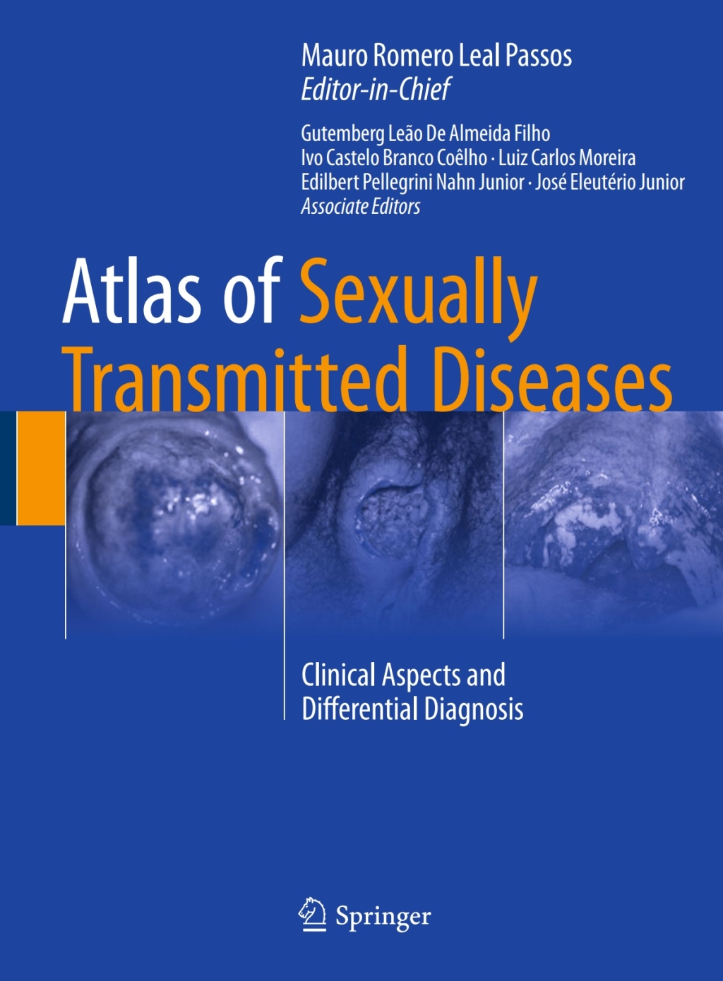 Atlas of Sexually Transmitted Diseases Clinical Aspects and ...