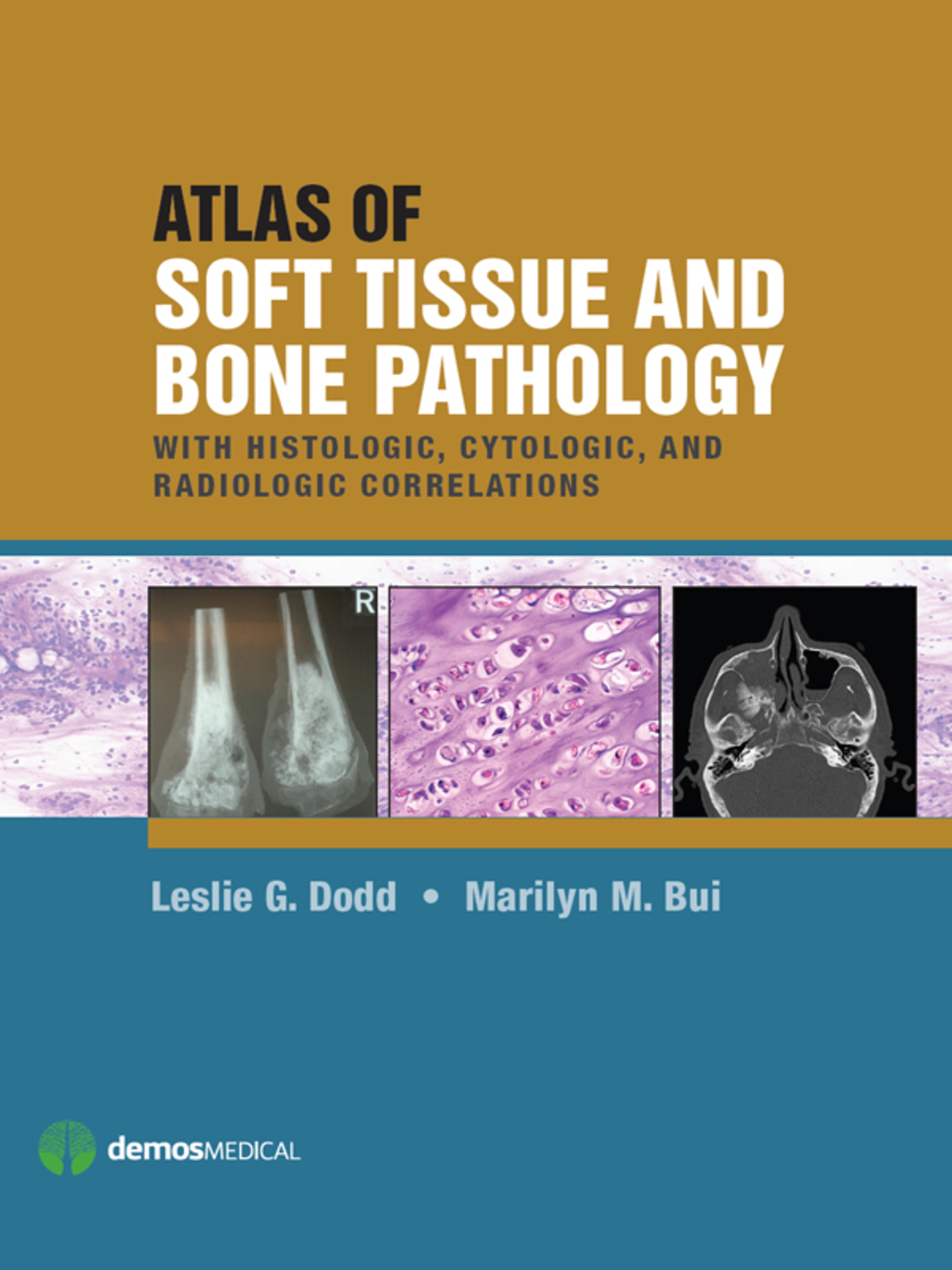 Atlas of Soft Tissue and Bone Pathology With Histologic, Cytologic, and Radiologic Correlations 1st Edition â€“ PDF/EPUB Version Downloadable