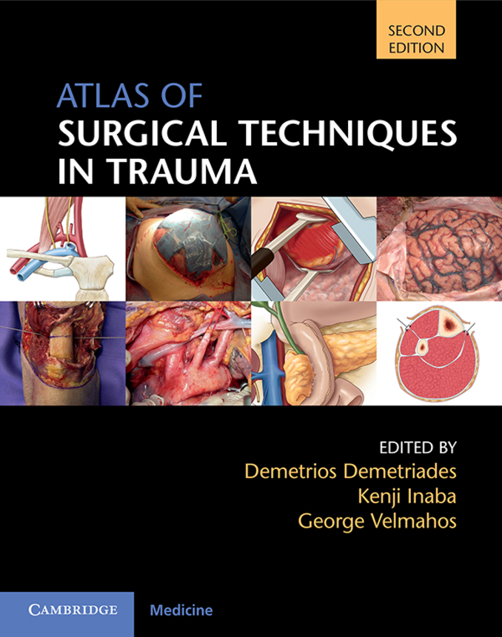Atlas of Surgical Techniques in Trauma 2nd Edition â€“ PDF/EPUB Version Downloadable