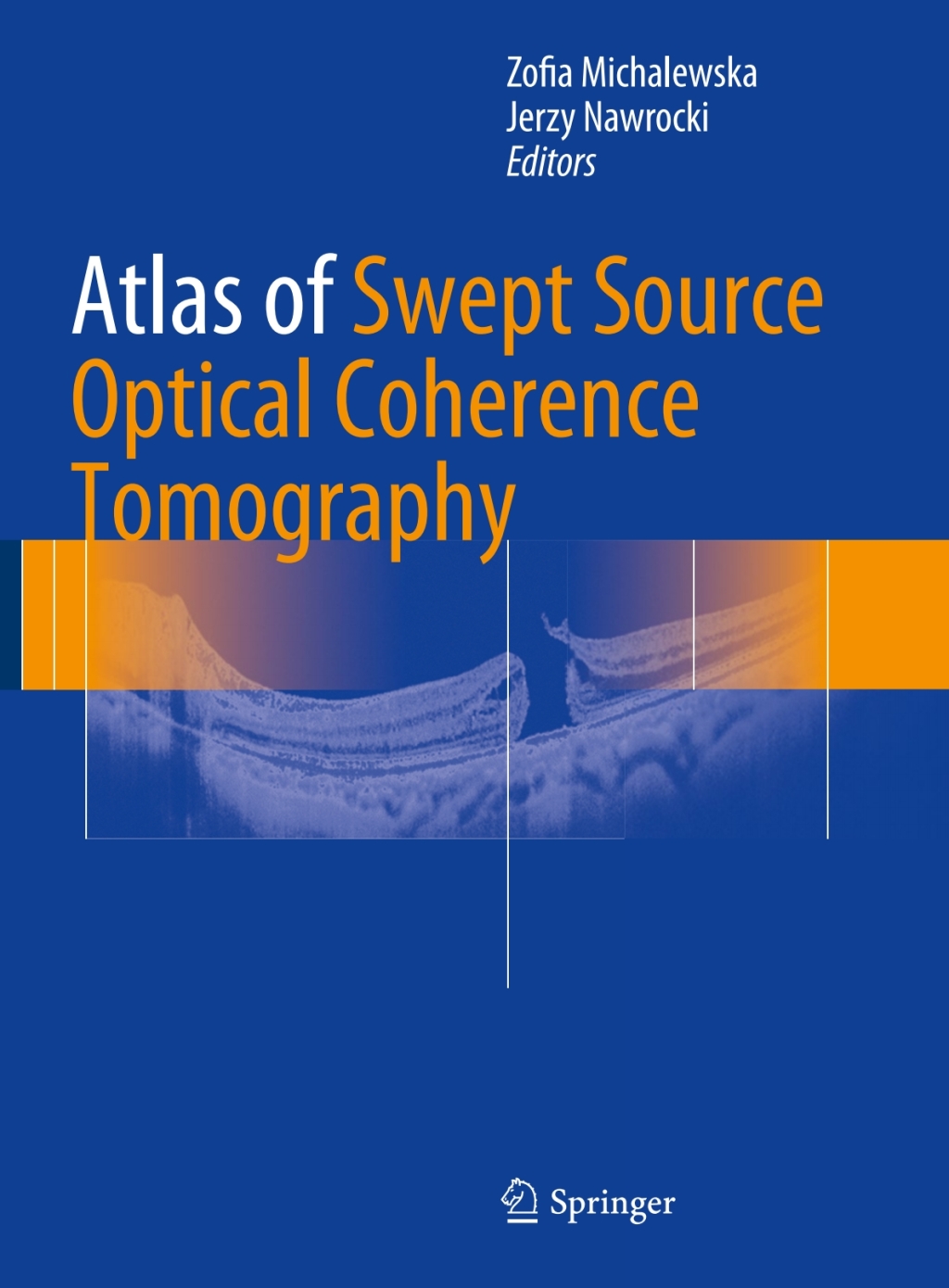 Atlas of Swept Source Optical Coherence Tomography â€“ PDF/EPUB Version ...