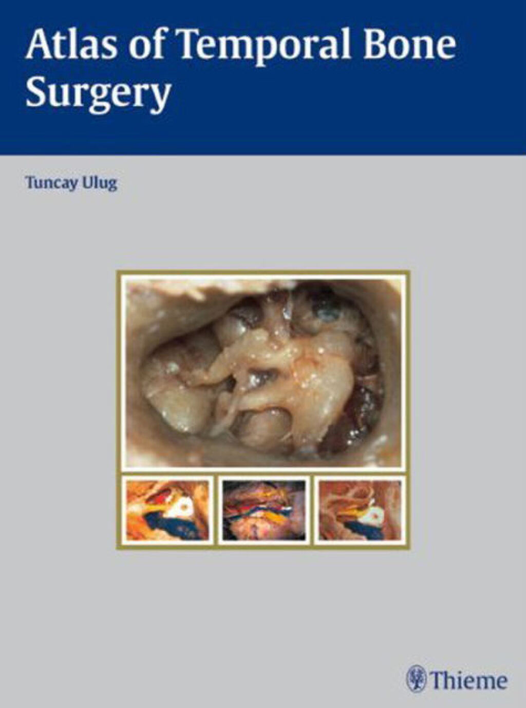 Atlas of Temporal Bone Surgery 1st Edition â€“ PDF/EPUB Version Downloadable