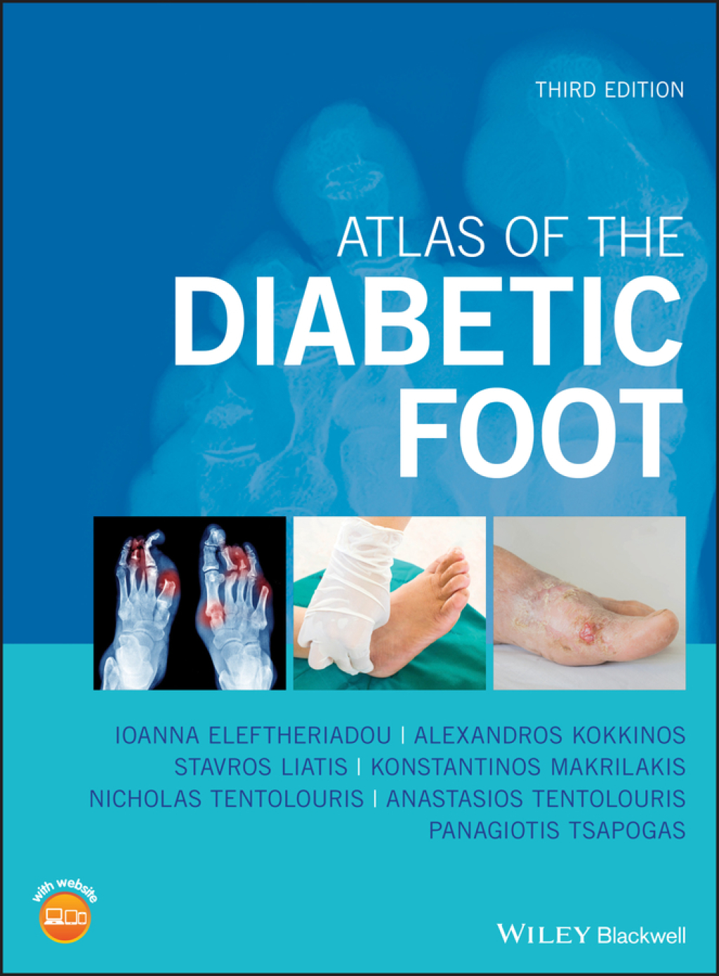 Atlas of the Diabetic Foot 3rd Edition â€“ PDF/EPUB Version Downloadable