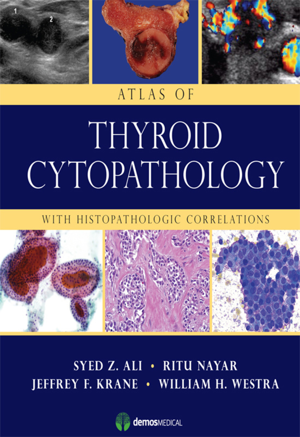 Atlas of Thyroid Cytopathology With Histopathologic Correlations 1st Edition â€“ PDF/EPUB Version Downloadable