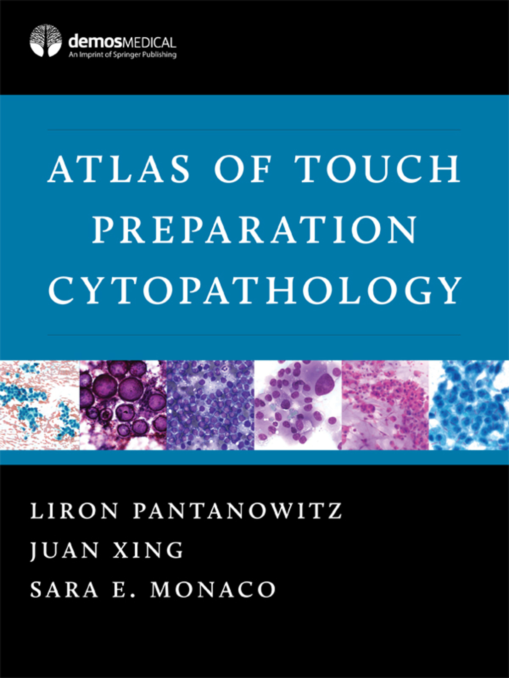 Atlas of Touch Preparation Cytopathology 1st Edition â€“ PDF/EPUB Version Downloadable