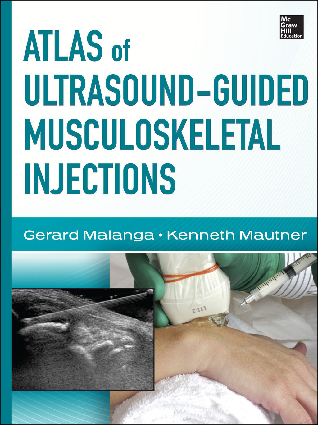 Atlas of Ultrasound-Guided Musculoskeletal Injections 1st Edition â€“ PDF/EPUB Version Downloadable