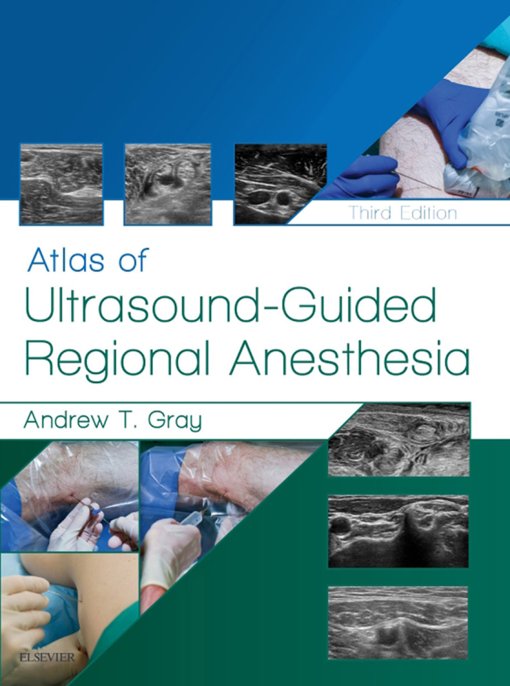 Atlas of Ultrasound-Guided Regional Anesthesia 3rd Edition â€“ PDF/EPUB Version Downloadable