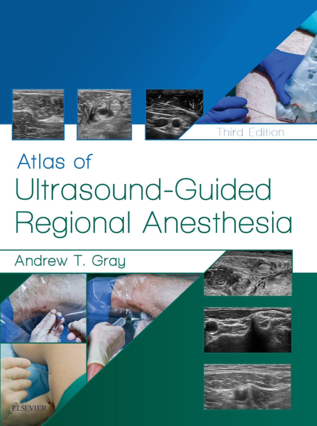 Atlas of Ultrasound-Guided Regional Anesthesia 3rd Edition â€“ PDF/EPUB Version Downloadable