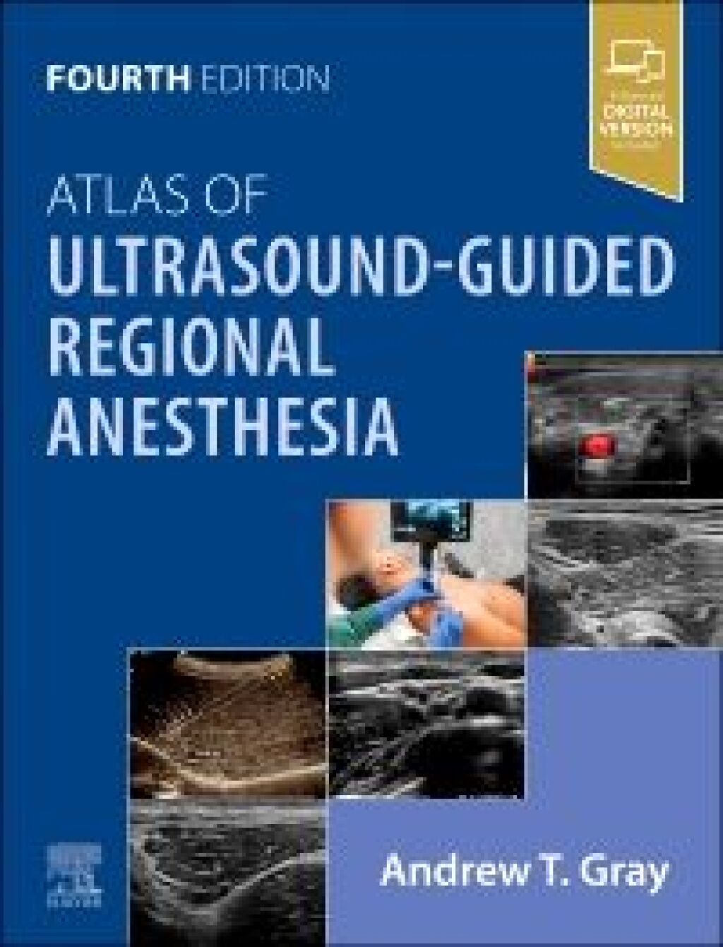 Atlas of Ultrasound-Guided Regional Anesthesia 4th Edition â€“ PDF/EPUB Version Downloadable