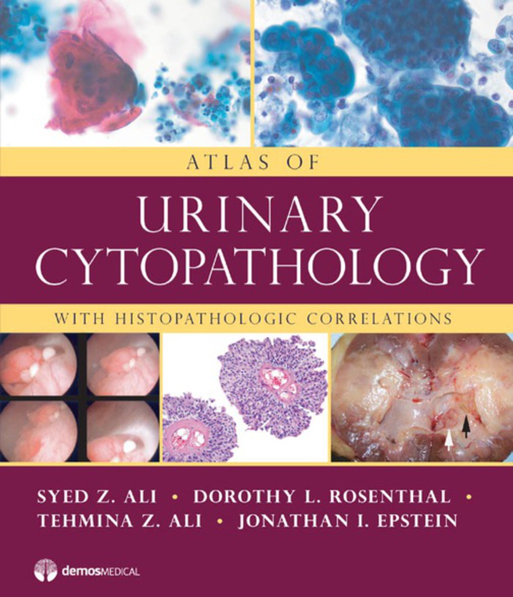 Atlas of Urinary Cytopathology With Histopathologic Correlations 1st Edition â€“ PDF/EPUB Version Downloadable