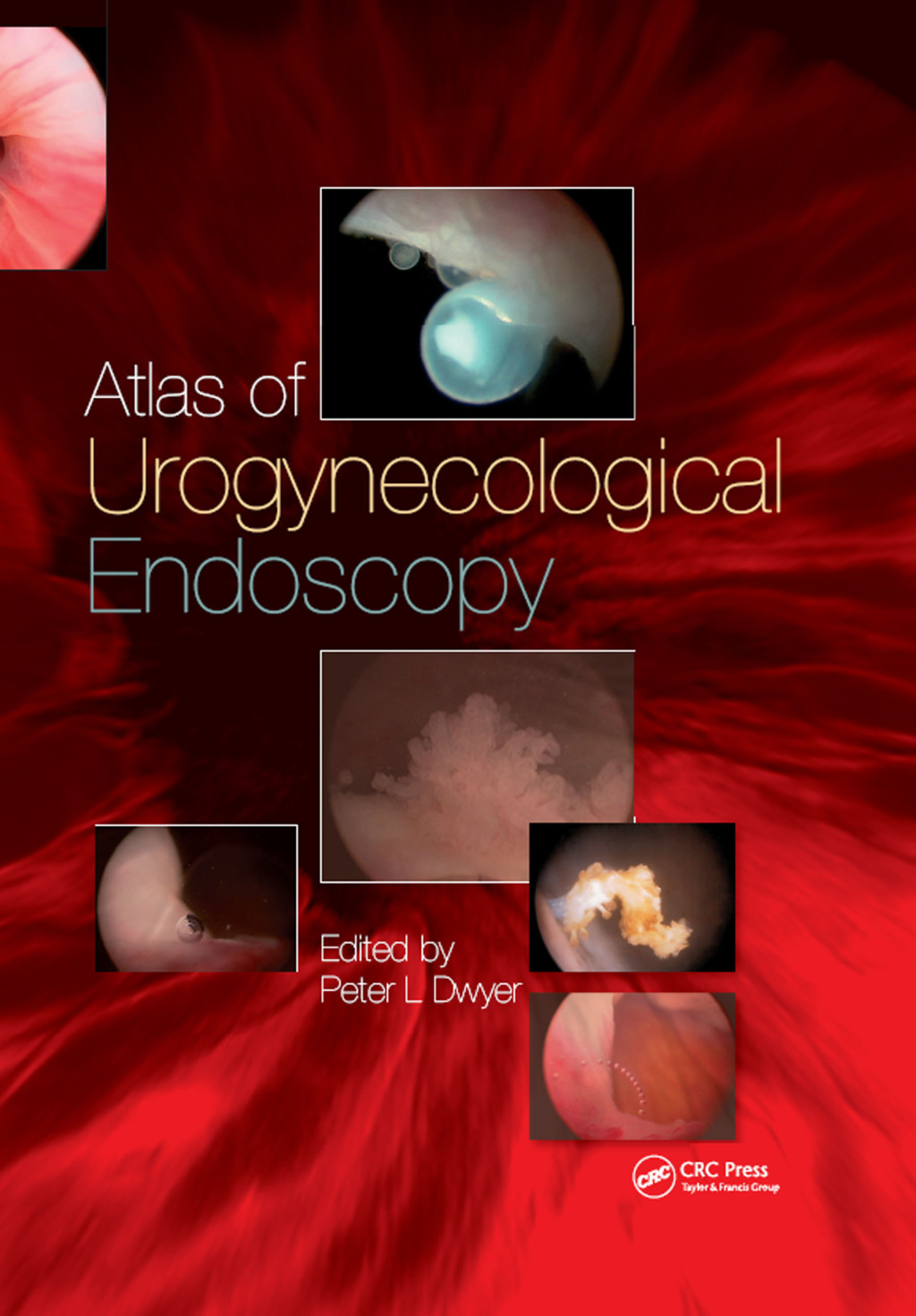 Atlas of Urogynecological Endoscopy 1st Edition â€“ PDF/EPUB Version Downloadable