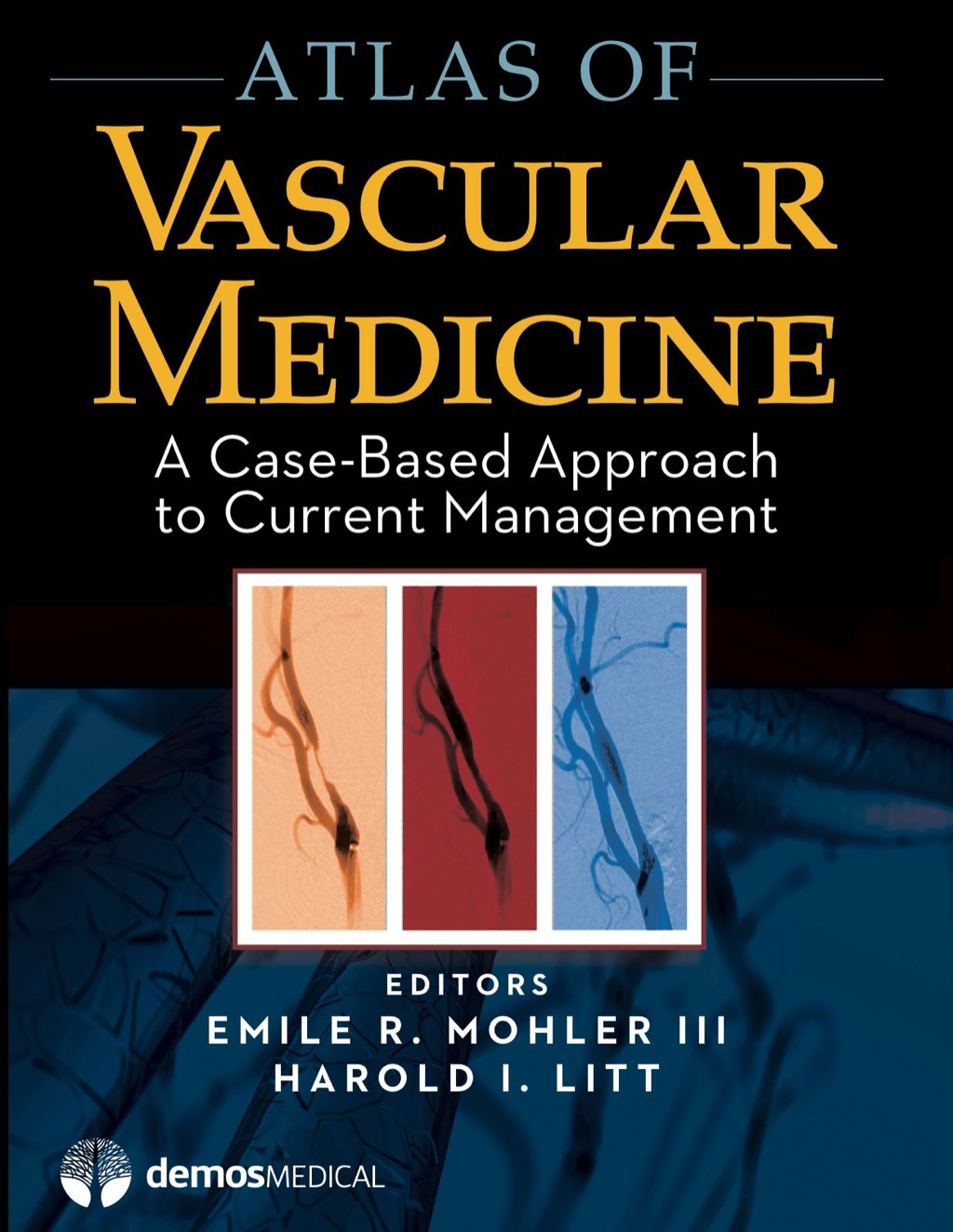 Atlas of Vascular Medicine A Case-Based Approach to Current Management 1st Edition â€“ PDF/EPUB Version Downloadable