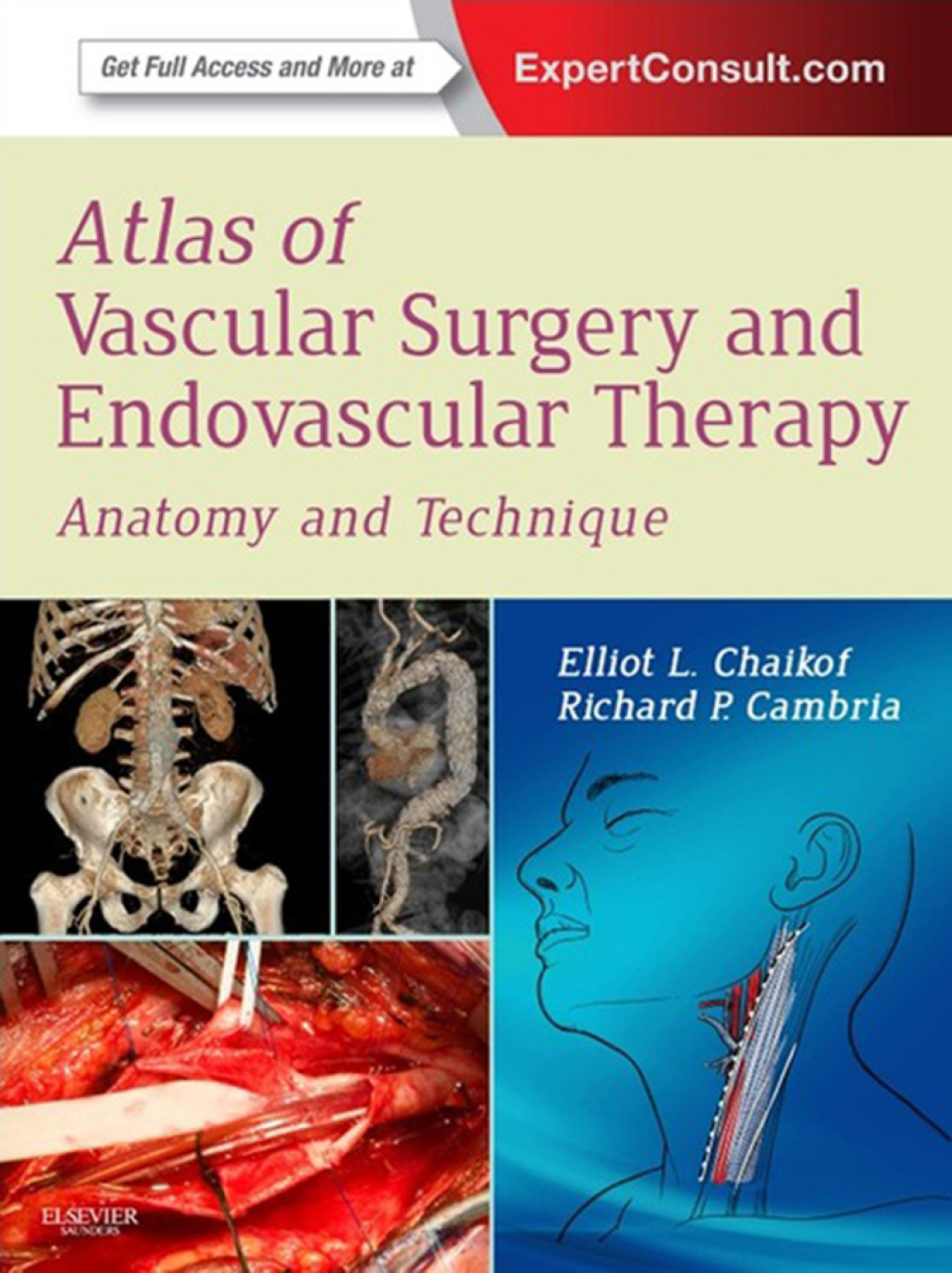 Atlas of Vascular Surgery and Endovascular Therapy Anatomy and Technique â€“ PDF/EPUB Version Downloadable