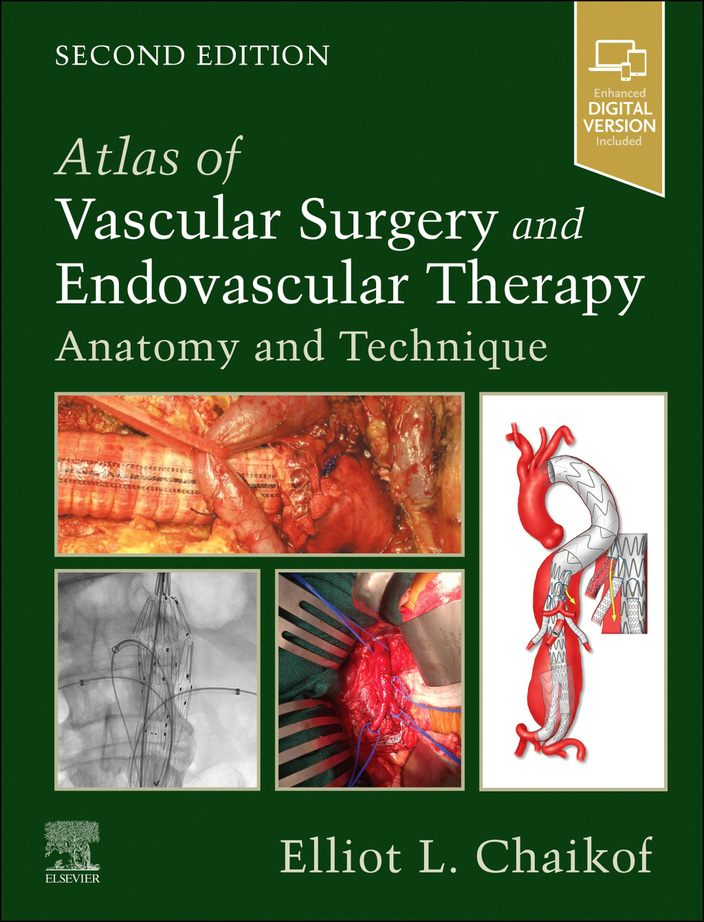 Atlas of Vascular Surgery and Endovascular Therapy Anatomy and Technique 2nd Edition â€“ PDF/EPUB Version Downloadable