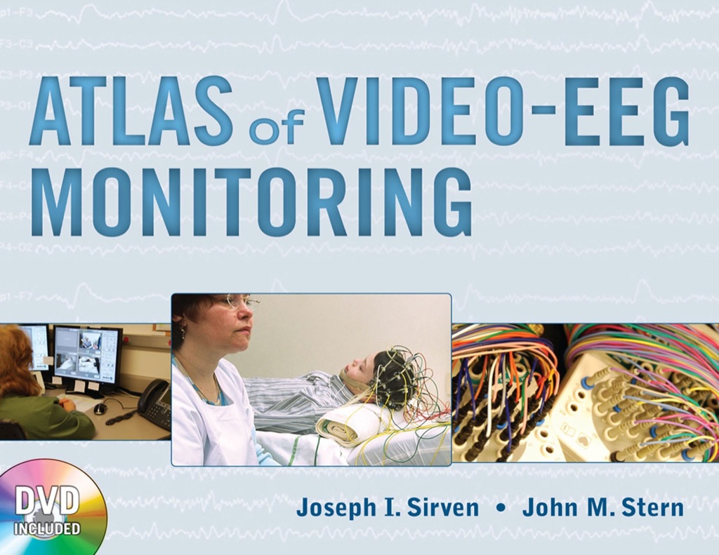 Atlas of Video-EEG Monitoring 1st Edition â€“ PDF/EPUB Version Downloadable