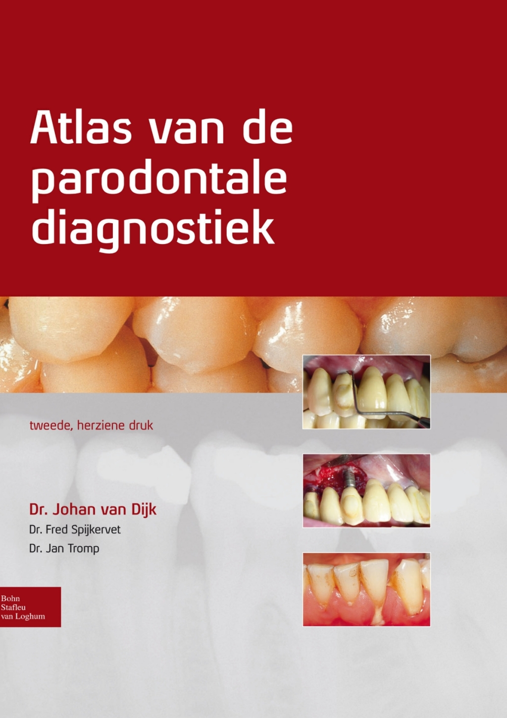 Atlas van de parodontale diagnostiek 2nd Edition â€“ PDF/EPUB Version Downloadable
