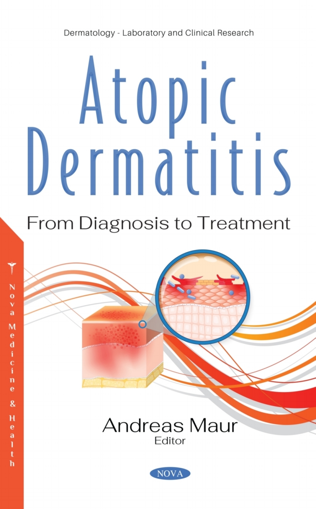 Atopic Dermatitis: From Diagnosis to Treatment â€“ PDF/EPUB Version Downloadable