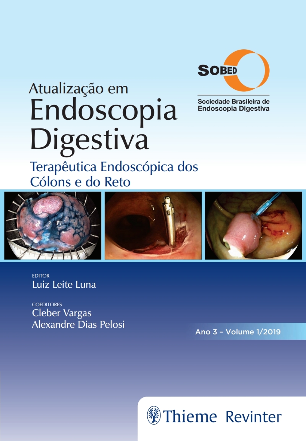 AtualizaÃ§Ã£o em Endoscopia Digestiva: TerapÃªutica EndoscÃ³pica dos CÃ³lons e do Reto 1st Edition â€“ PDF/EPUB Version Downloadable