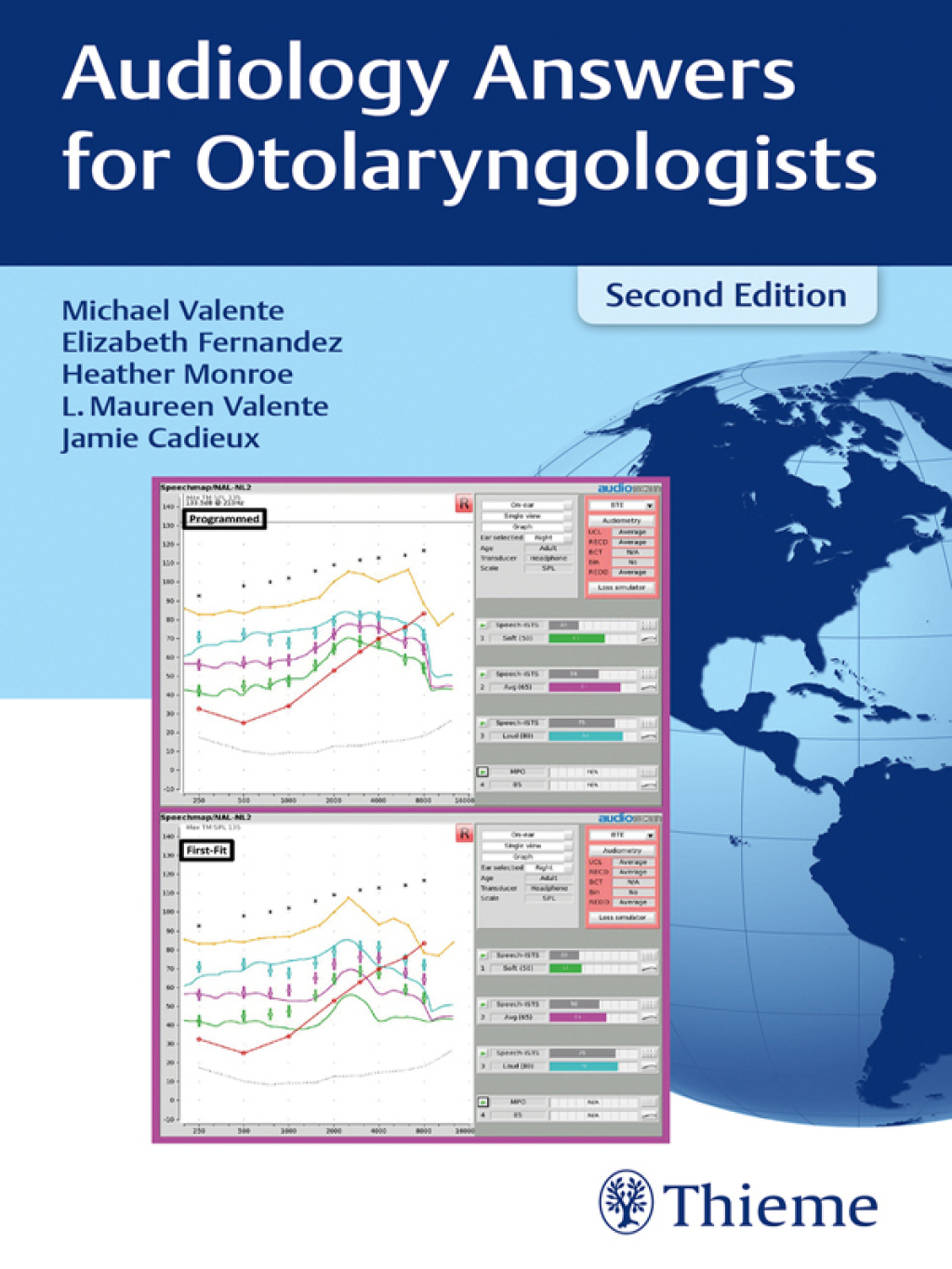 Audiology Answers for Otolaryngologists 2nd Edition â€“ PDF/EPUB Version Downloadable